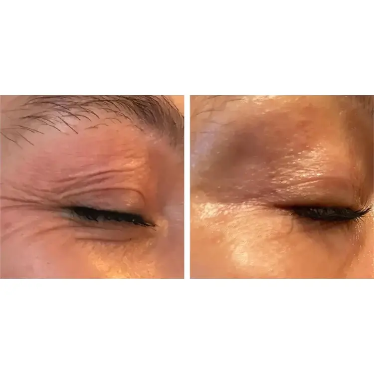 LUNA MICROCARE ETERNAL Paakių pleistrai prieš senėjimą ir raukšles LUNA MICROCARE ETERNAL Paakių pleistrai prieš senėjimą ir raukšles